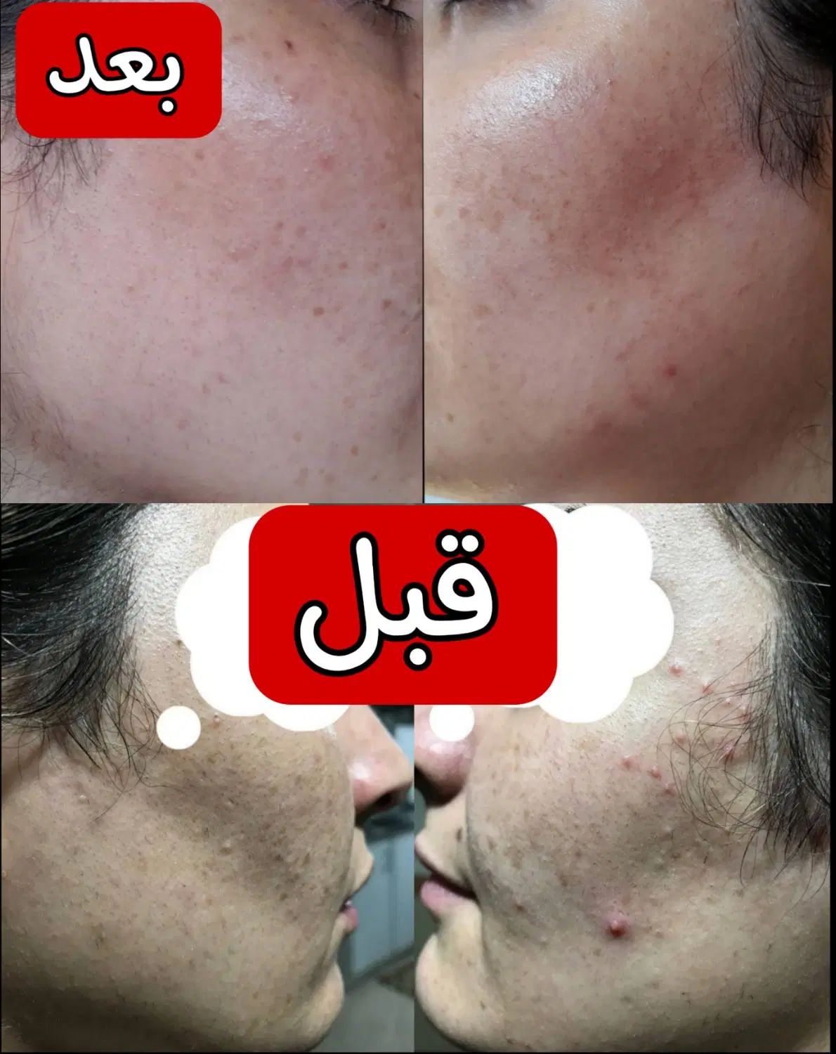 کرم معجزه جوانی|آرایشی، بهداشتی، درمانی|گرگان, |دیوار