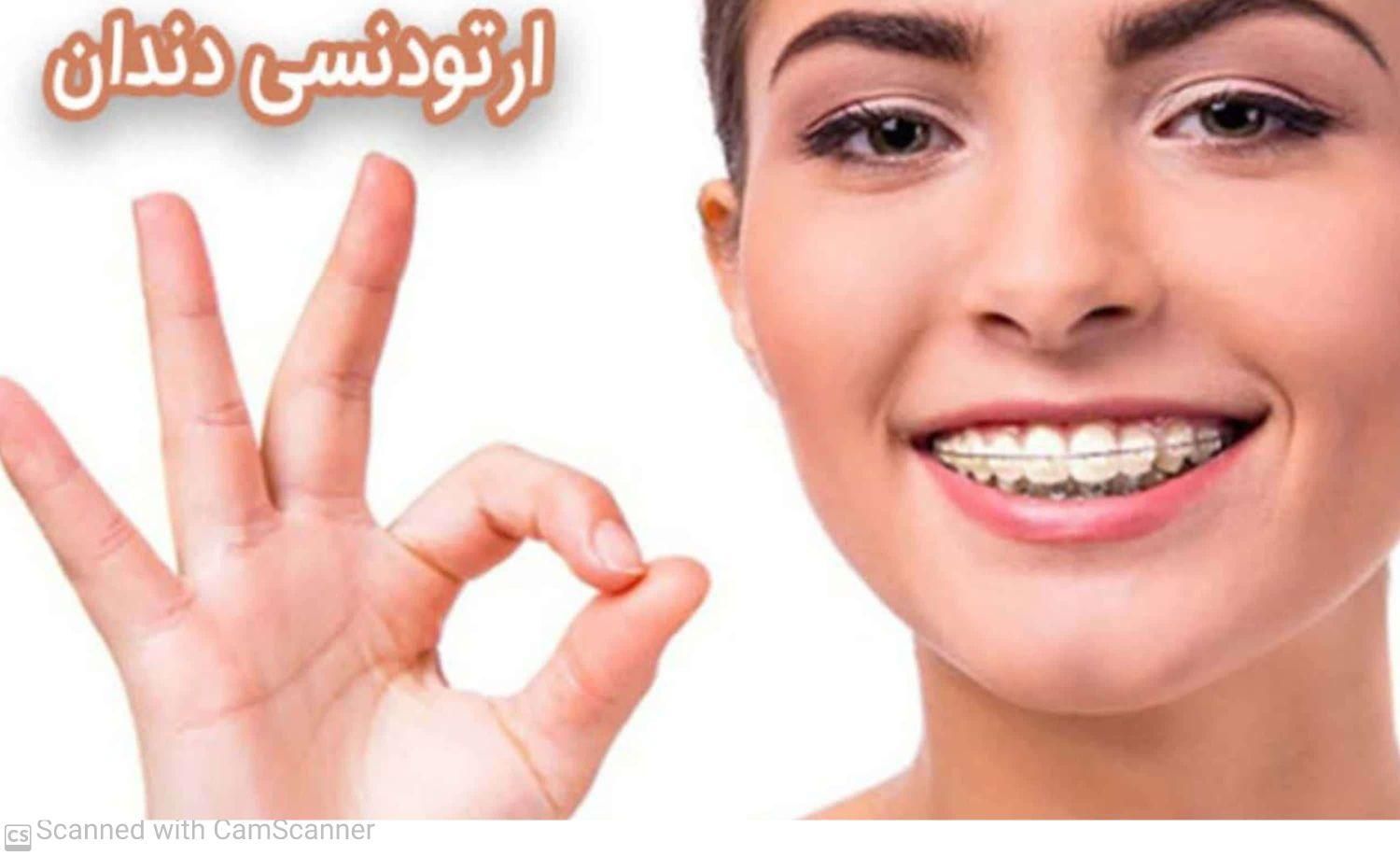 دندانپزشکی ارتودنسی دندان زیبایی صورت|خدمات آرایشگری و زیبایی|مشهد, جنت|دیوار