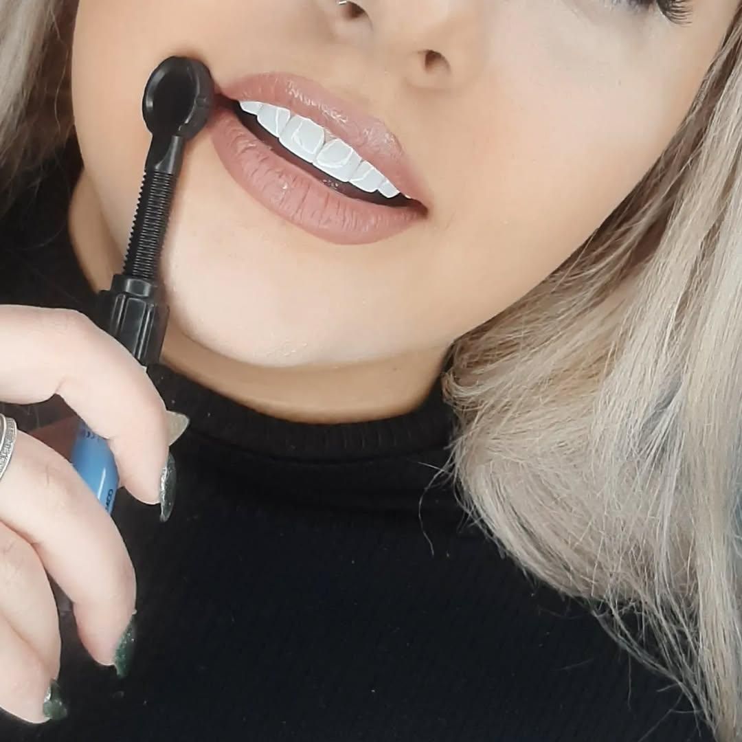 کامپوزیت دندان ((ویژه))|خدمات آرایشگری و زیبایی|یاسوج, |دیوار