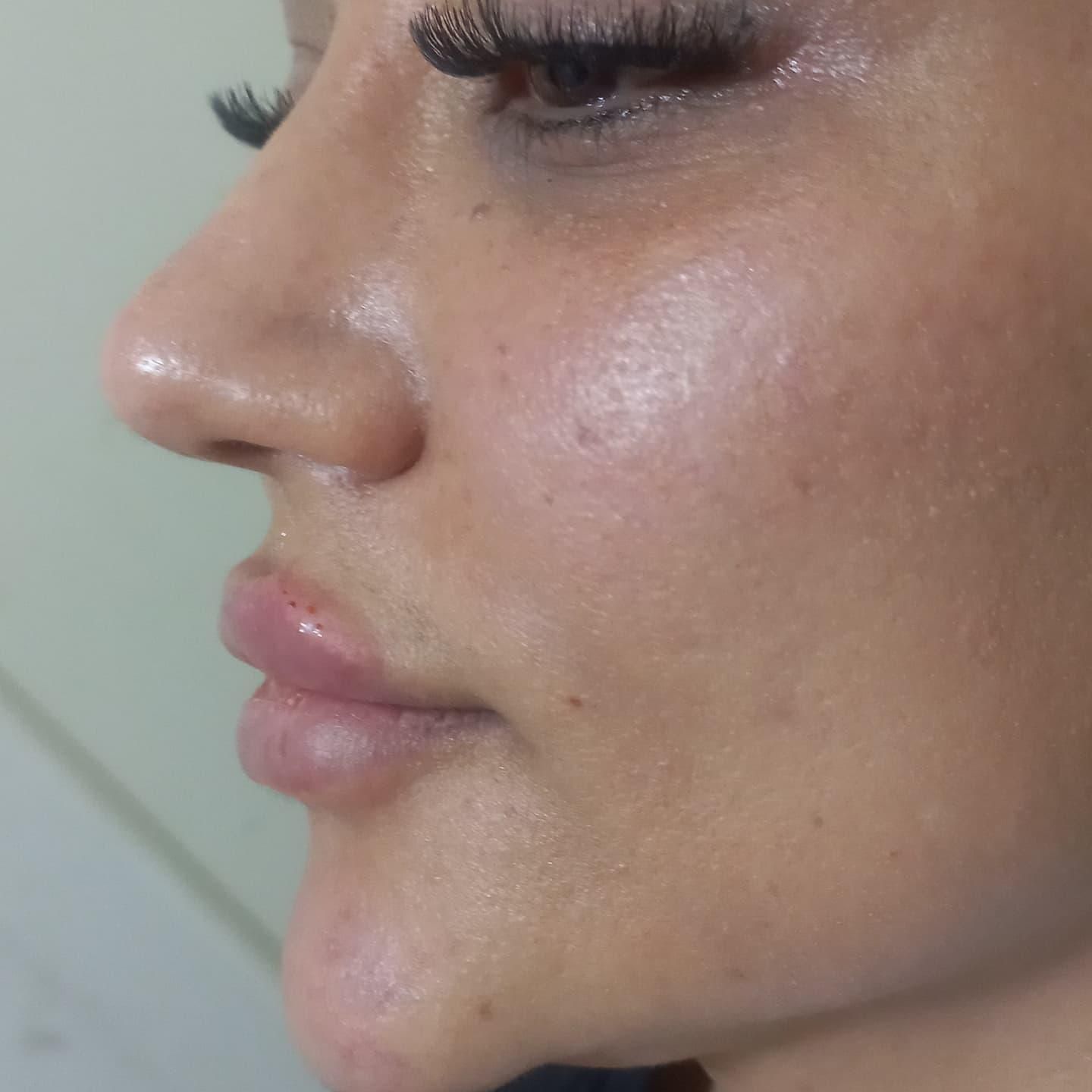 جوانساز پوست|خدمات آرایشگری و زیبایی|کرج, شهرک ظفر|دیوار