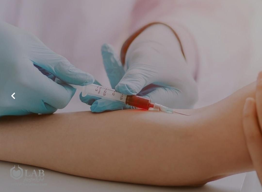 خونگیری آزمایش در منزل چکاب خدمات پرستاری|خدمات آرایشگری و زیبایی|شیراز, باغ تخت|دیوار
