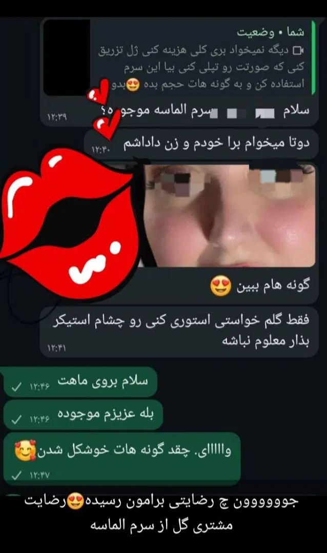دیگه نیازی نیس کلی هزینه کنی ژل تزریق کنی|آرایشی، بهداشتی، درمانی|بهبهان, |دیوار