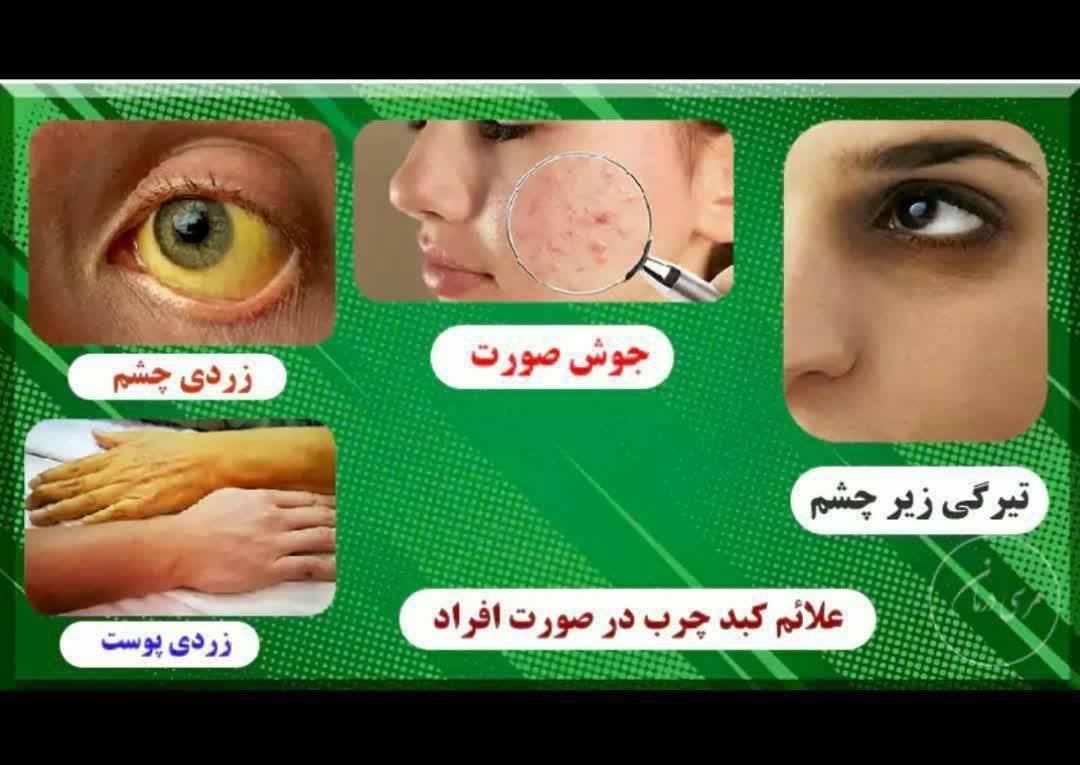 درآمد زایی آنلاین طب سنتی|خدمات آموزشی|رشت, بازار|دیوار