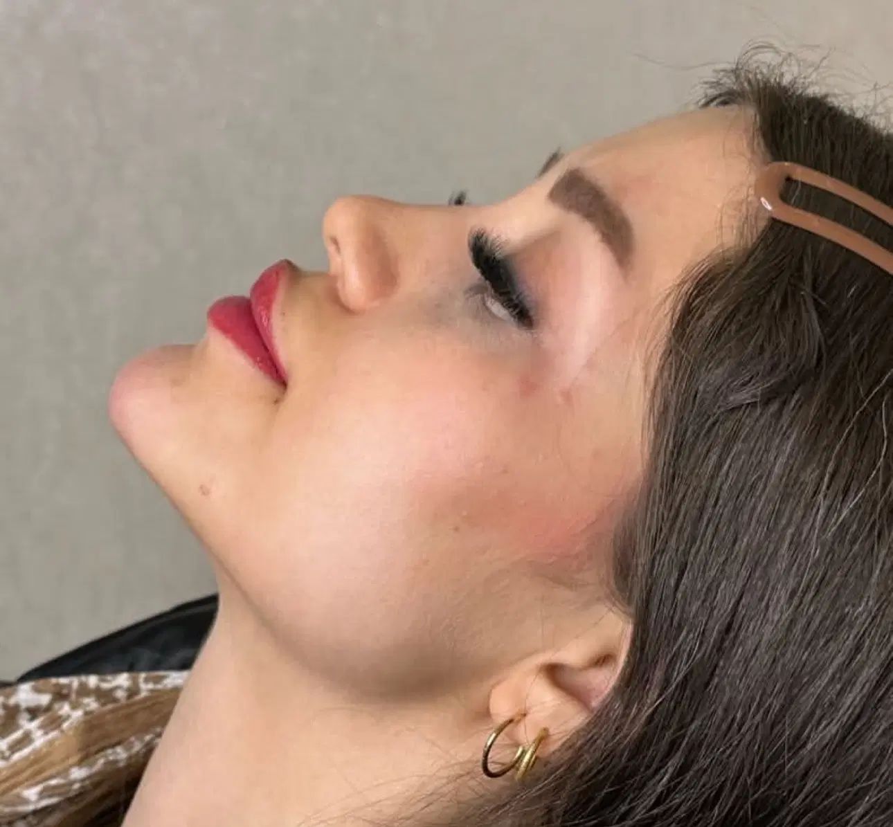 جشنواره تزریق ژل بوتاکس پکیج کانتورینگ لیفت ابرونخ|خدمات آرایشگری و زیبایی|تهران, اباذر|دیوار