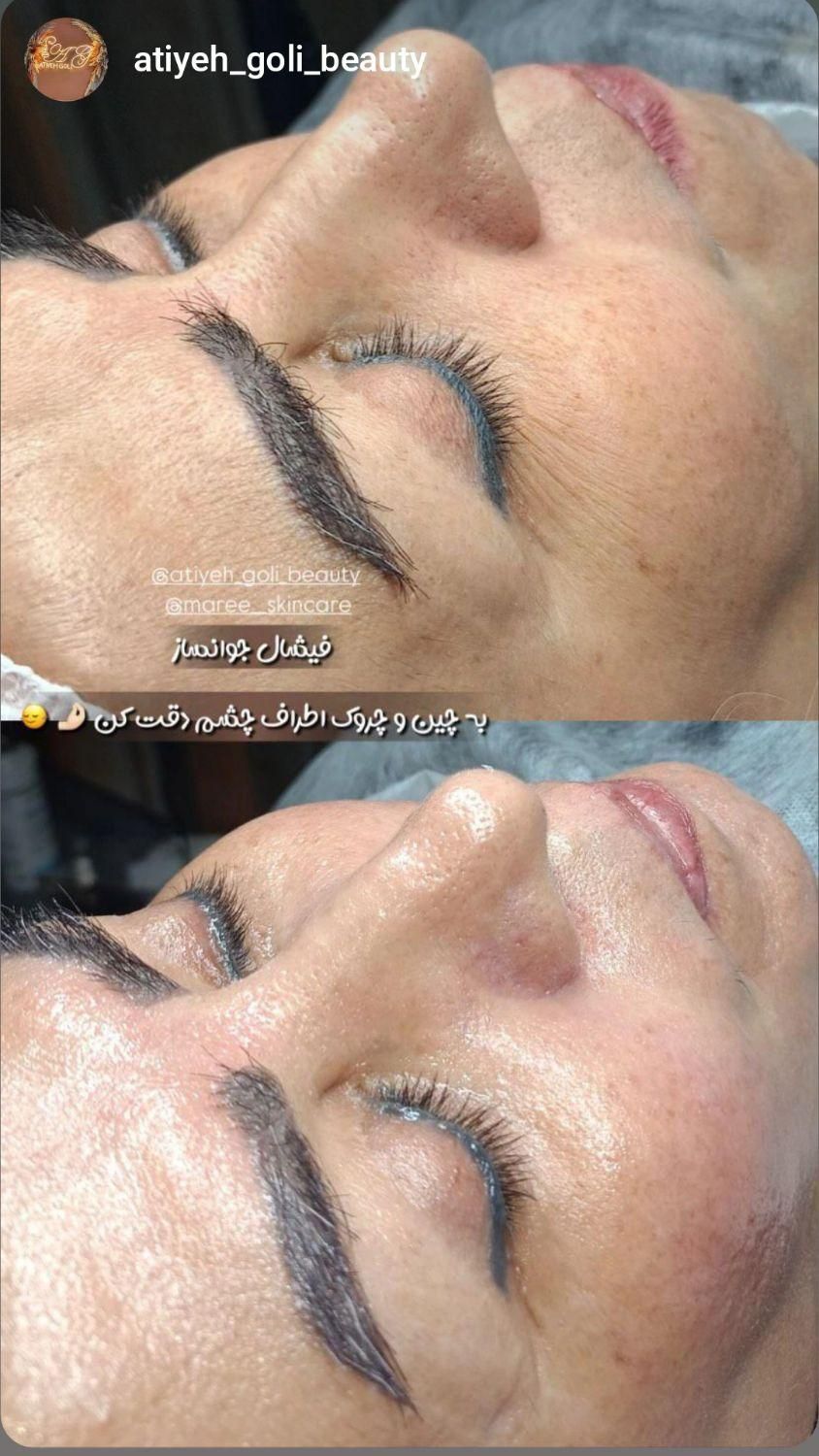 جشنواره تخفیفی فیشال تخصصی صورت|خدمات آرایشگری و زیبایی|مشهد, هفده شهریور|دیوار