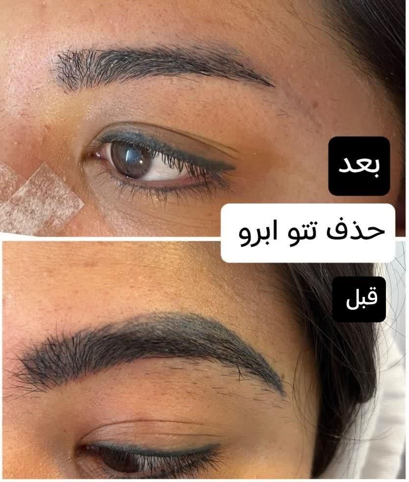 لیزر مو زائدآقاخانم(کل بدن رایگان) شعبه دوم|خدمات آرایشگری و زیبایی|نجف‌آباد, بازار|دیوار