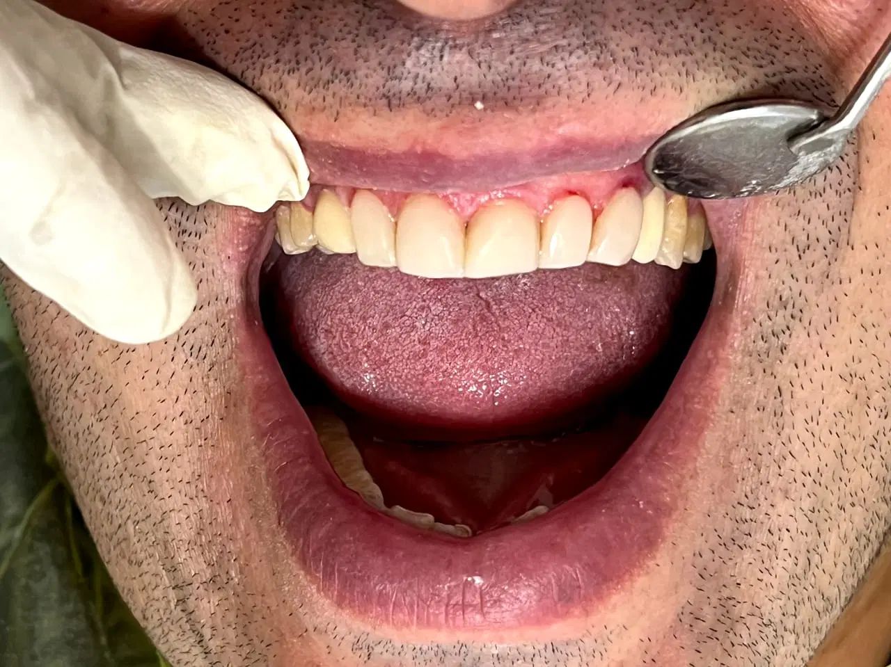 دندانپزشکی اطفال و بزرگسال|خدمات آرایشگری و زیبایی|رشت, پل تالشان|دیوار