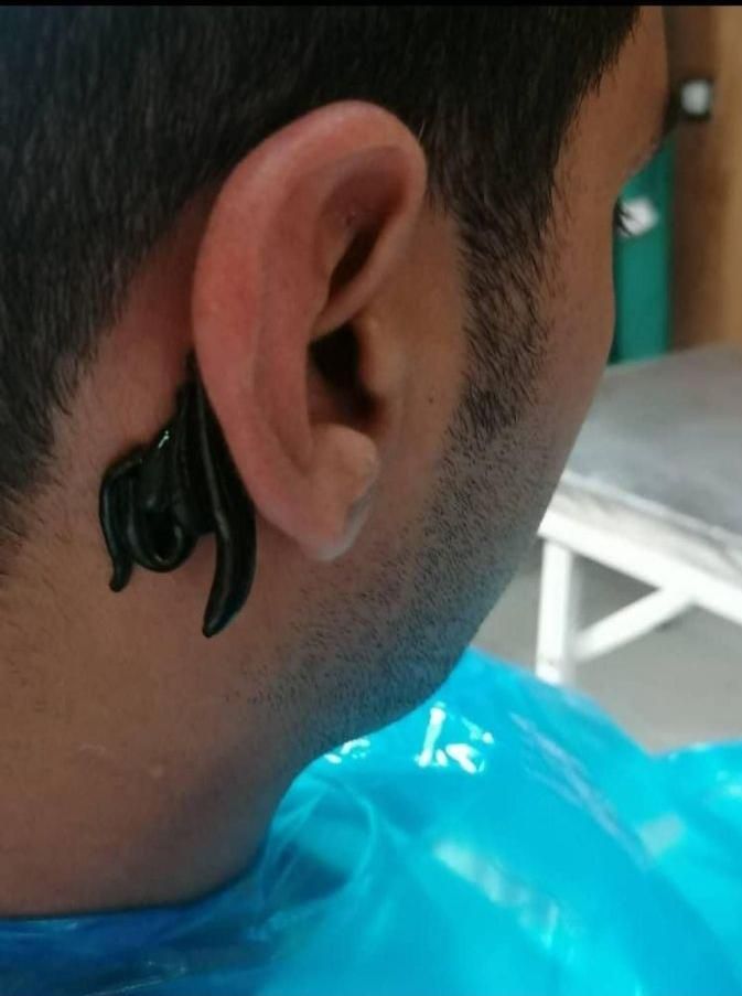 کلینیک لیزر کرایو زگیل خال میخچه حجامت زالو بوتاکس|خدمات آرایشگری و زیبایی|شیراز, حافظیه|دیوار
