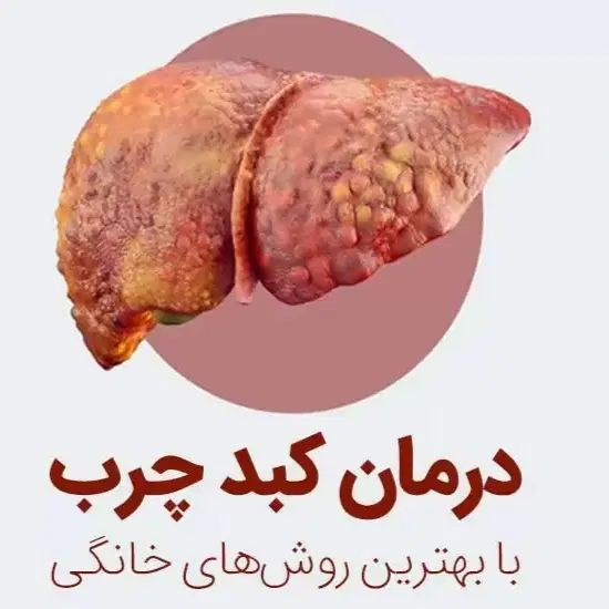 درمان قطعی کبد چرب|آرایشی، بهداشتی، درمانی|تبریز, |دیوار