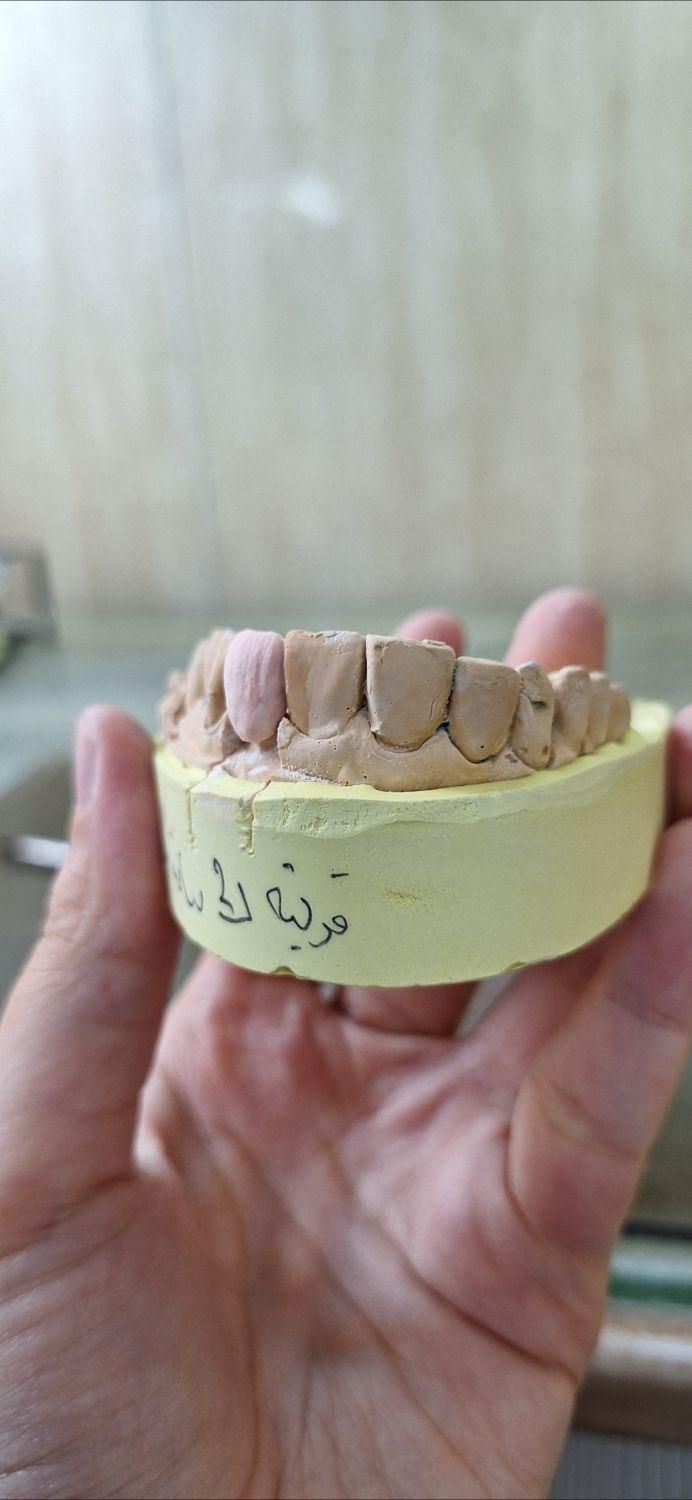 سلام کسی هست که در حوزه دندانسازی تازه وارد شده|گردهمایی و همایش|تهران, پیروزی|دیوار