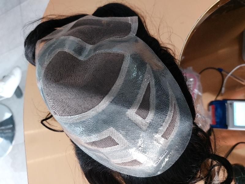 پروتز مو|آرایشی، بهداشتی، درمانی|تهران, نارمک|دیوار