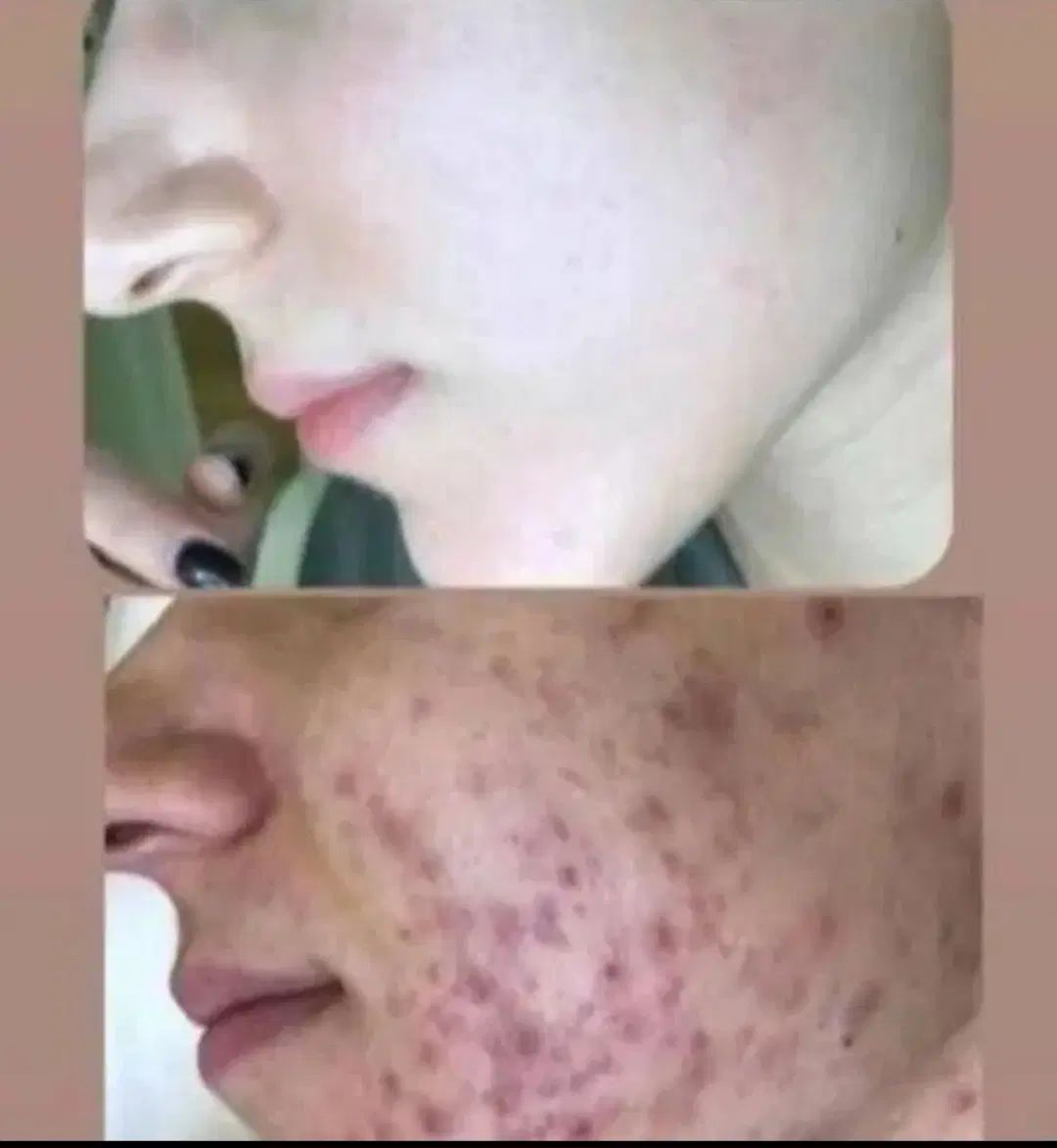 فرمول قوی سفیدکننده صورت و دست وپا تضمینی|آرایشی، بهداشتی، درمانی|سراوان, |دیوار