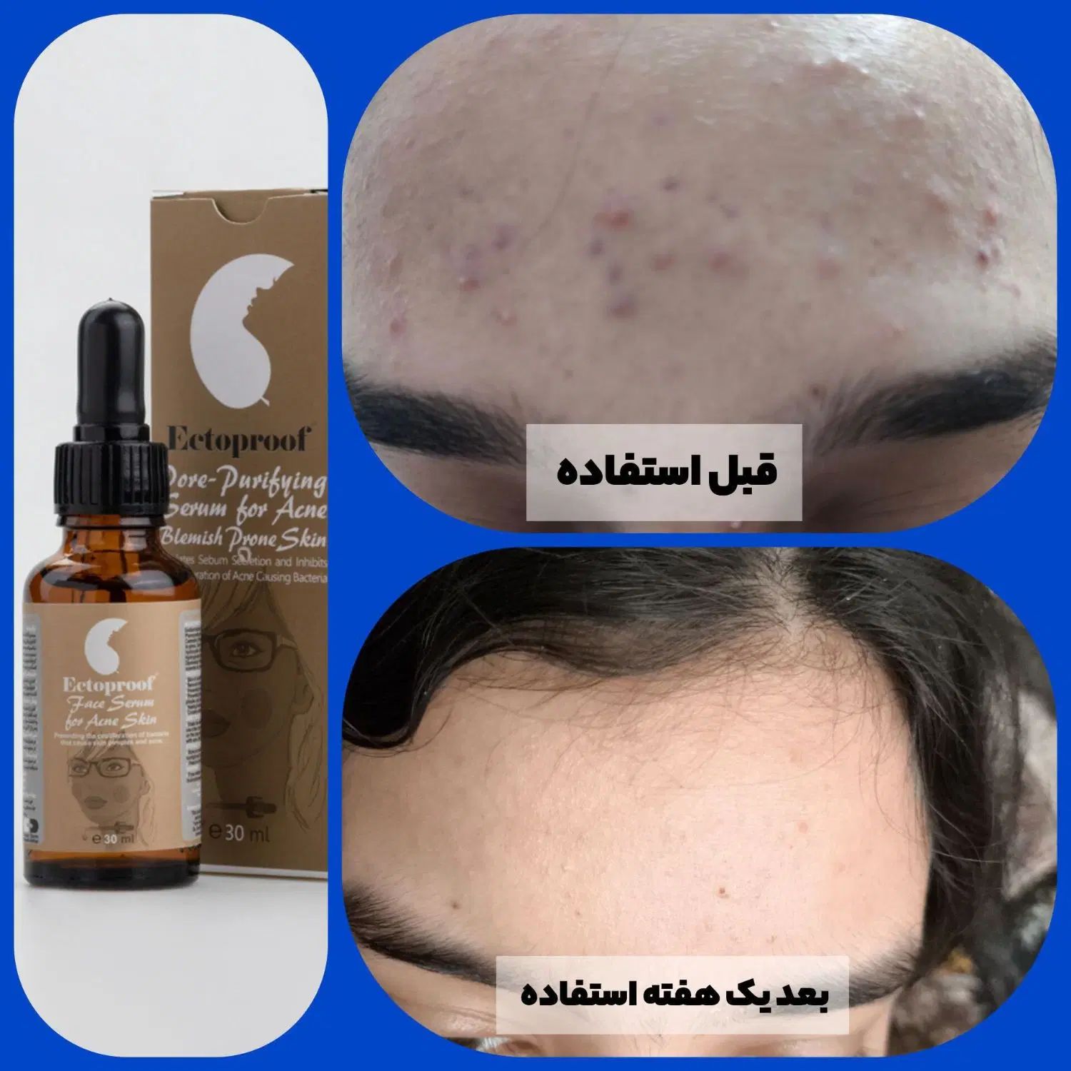 «پوستت رو متحول کن »|خدمات آرایشگری و زیبایی|کرج, دولت‌آباد|دیوار