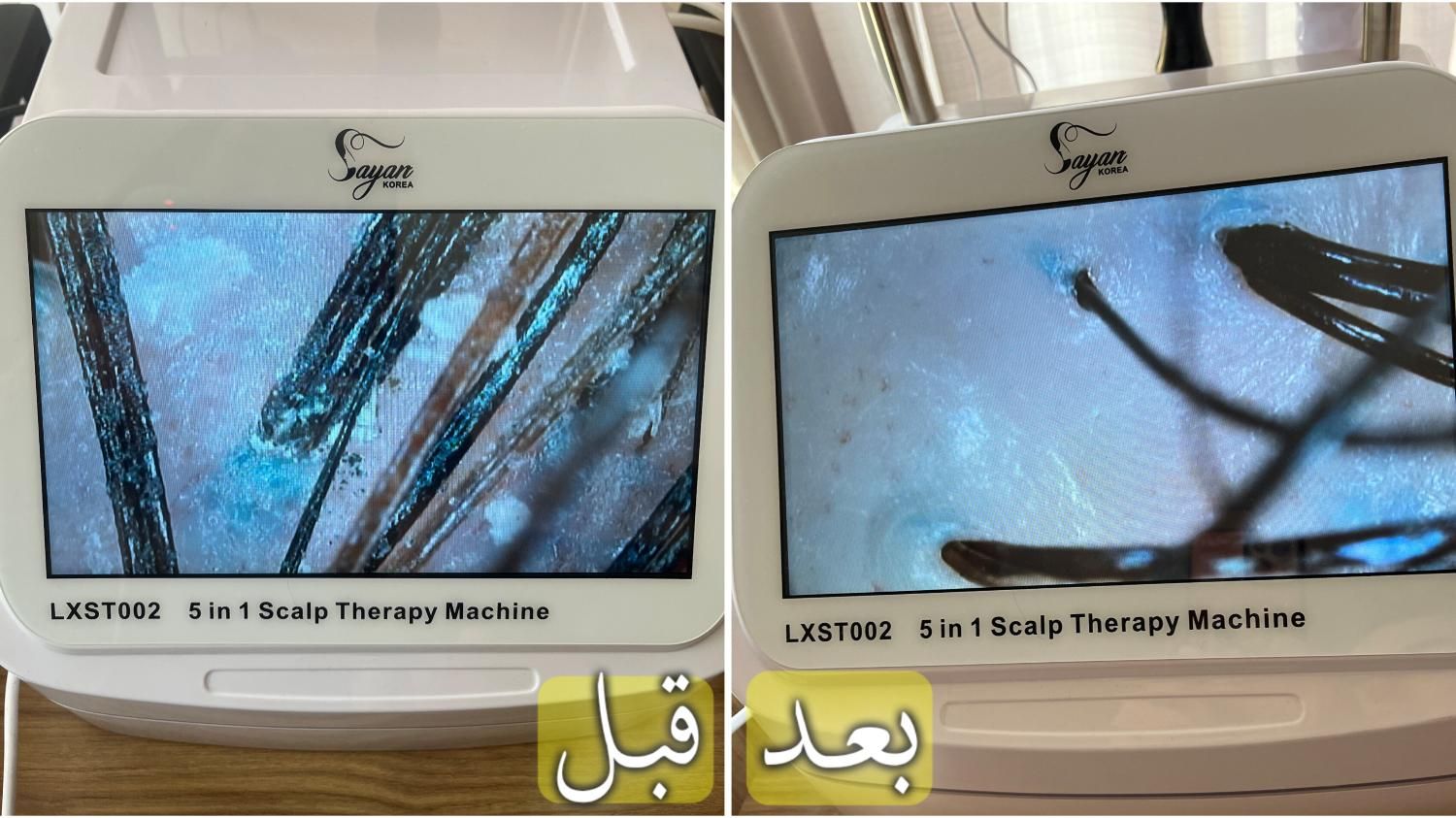 درمان قطعی شوره ،چربی،و انواع ریزش های مو|خدمات آرایشگری و زیبایی|اصفهان, چشمه باقرخان|دیوار