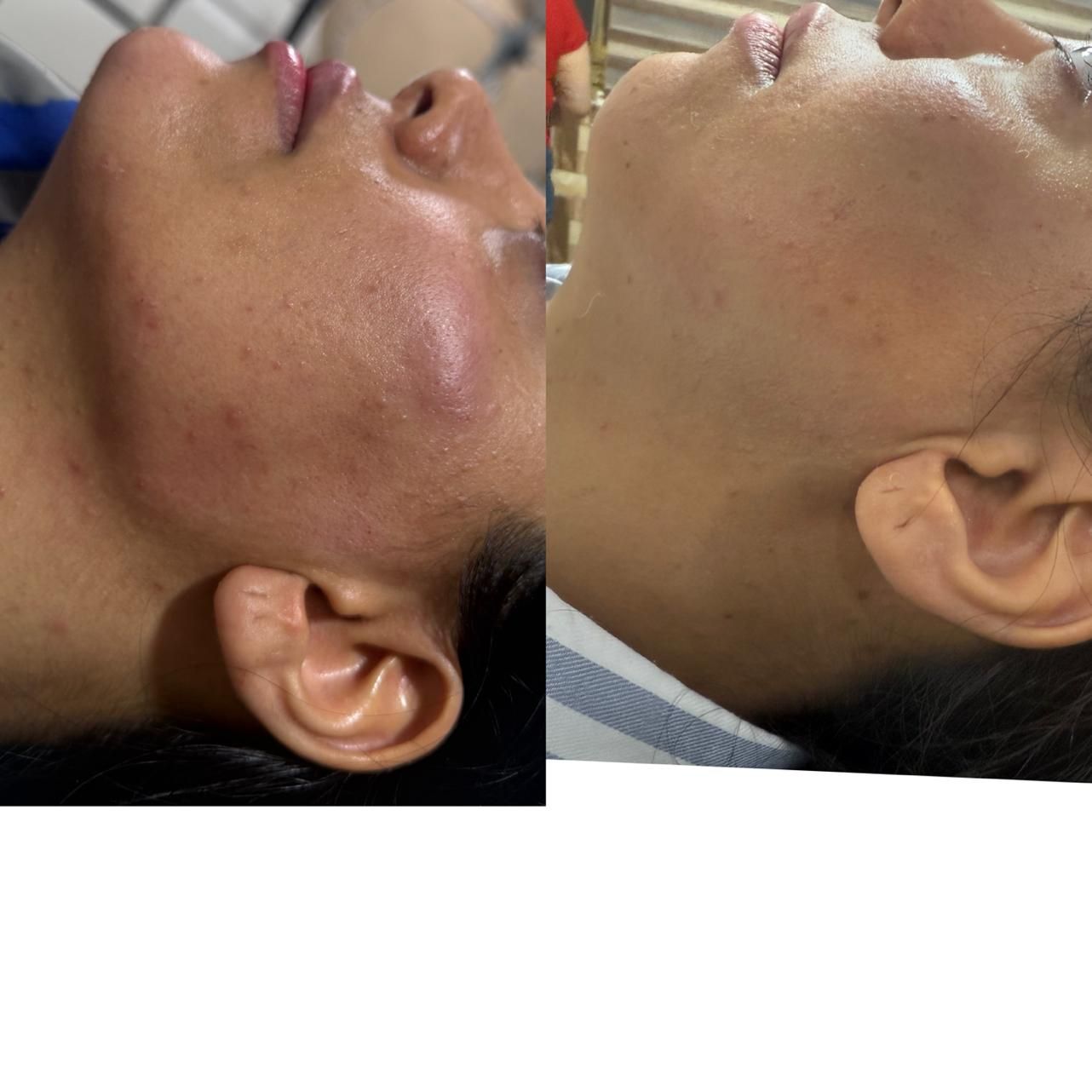 تزریق ژل سی سی 600|خدمات آرایشگری و زیبایی|پیشوا, |دیوار