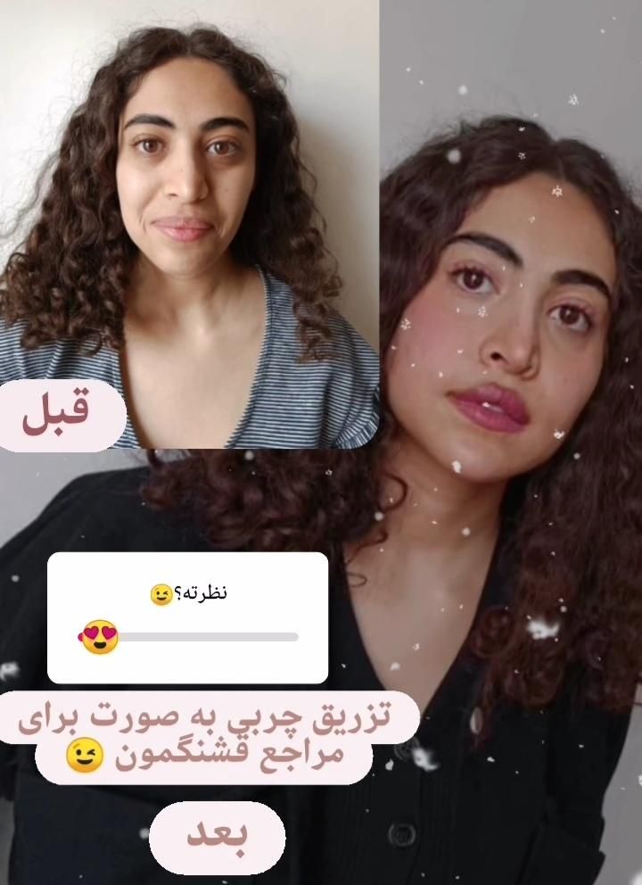 فیلر بیکینی ، لابیا پلاستی ترانسفر باسن بایوفیلر|خدمات آرایشگری و زیبایی|اندیشه, اندیشه فاز ۱|دیوار