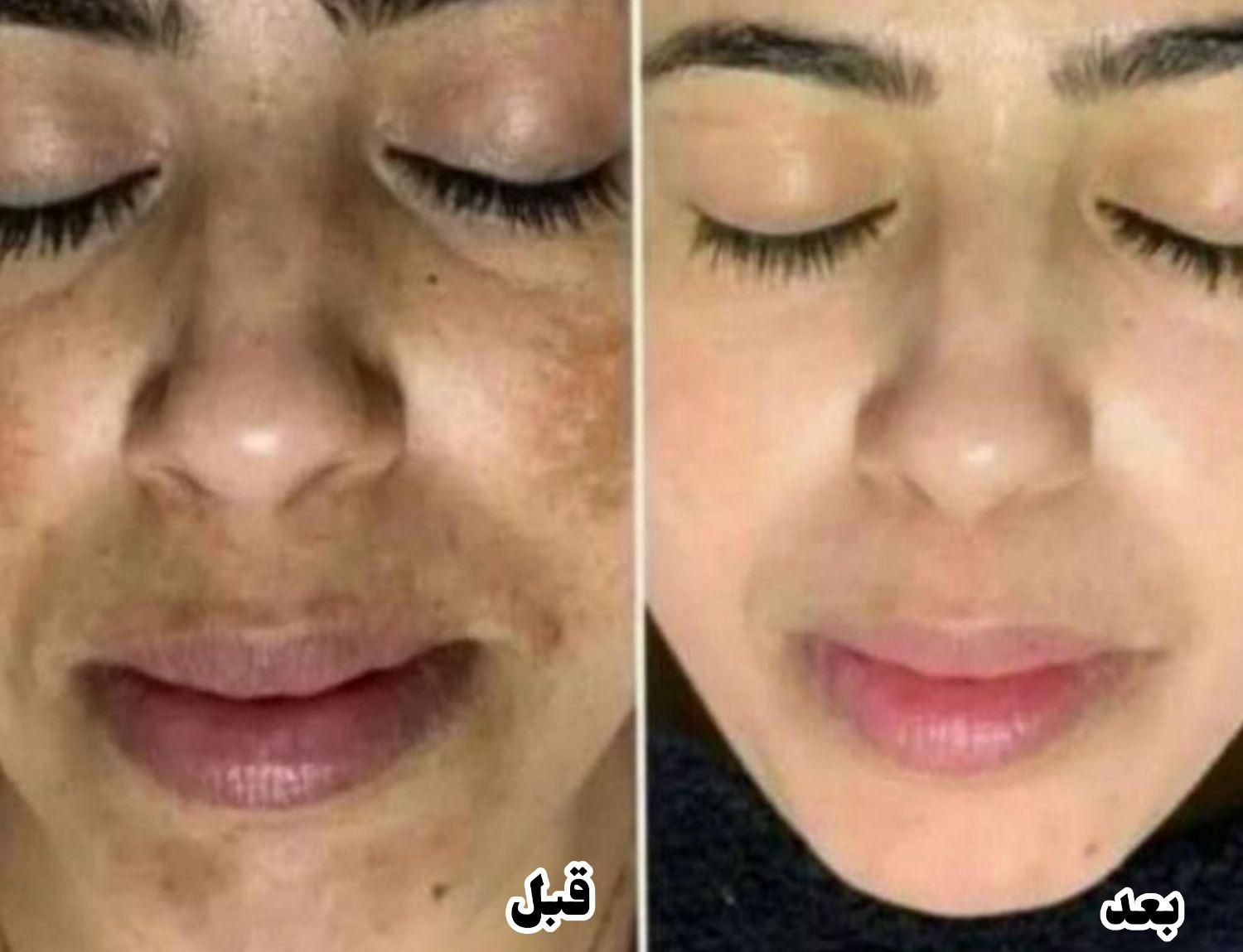 خدمات،آموزش ماساژ و حرکات اصلاحی +اصلاح سبک زندگی|خدمات آرایشگری و زیبایی|اندیشه, اندیشه فاز ۴|دیوار