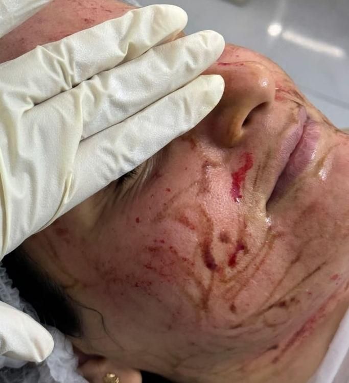 اولین درمانگرلک با متدپکینگ آپ وحذف تک جلسه کک مک|خدمات آرایشگری و زیبایی|بوشهر, |دیوار