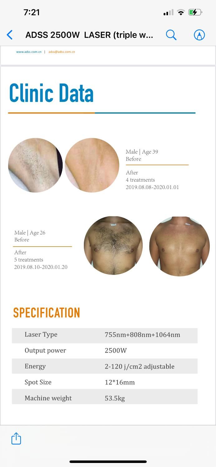 لیزر موهای زائد با دستگاه آلمانی 20%تخفیف|خدمات آرایشگری و زیبایی|سیرجان, |دیوار