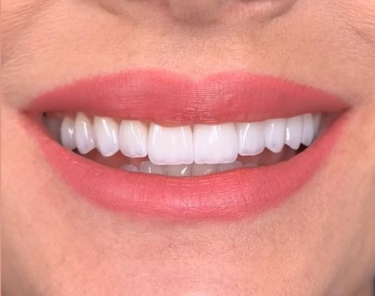 ونیر کامپوزیت لبه شیشه ای|خدمات آرایشگری و زیبایی|ارومیه, |دیوار