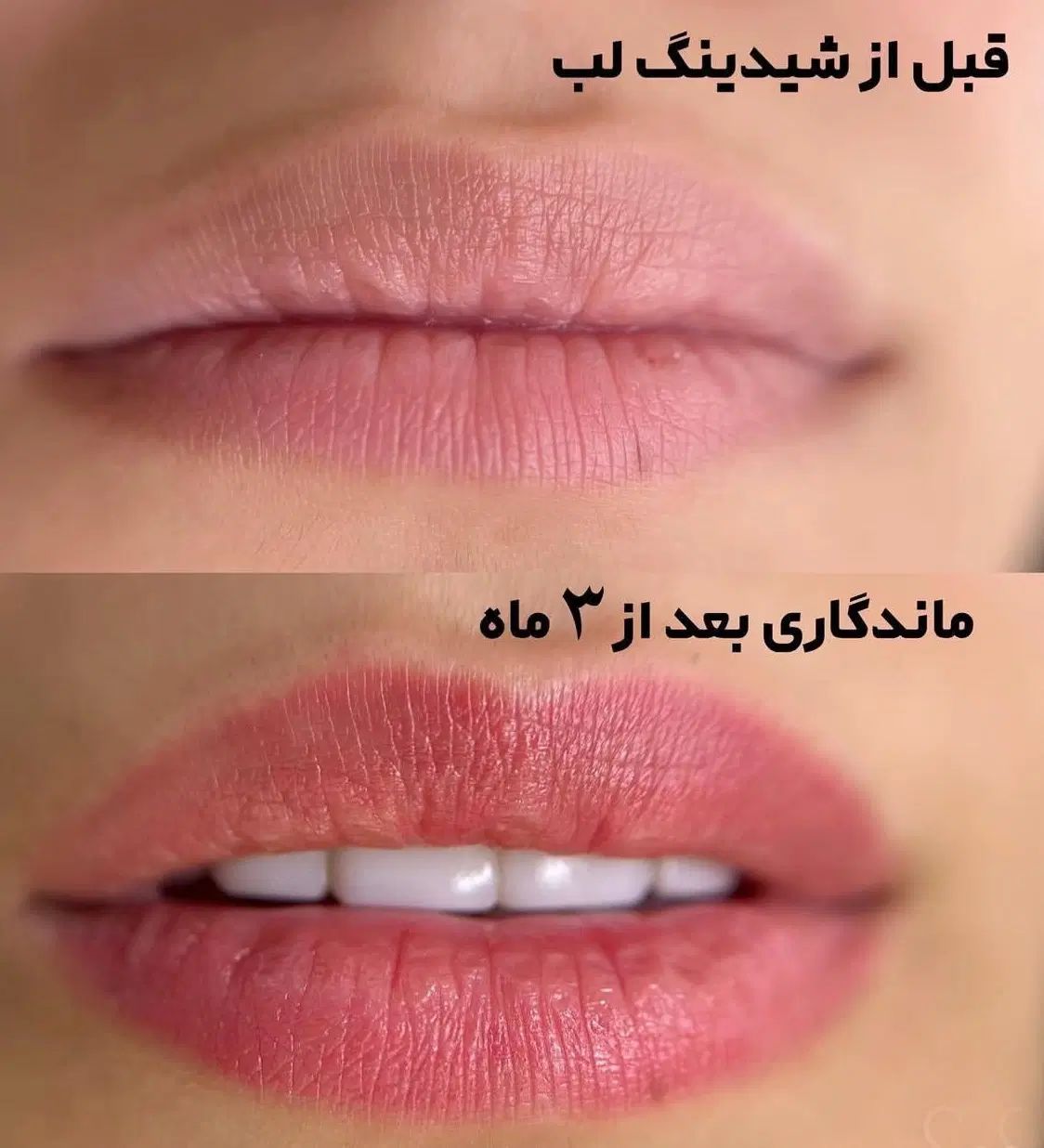 تخفیف شیدینگ لب|خدمات آرایشگری و زیبایی|مشهد, فلسطین|دیوار