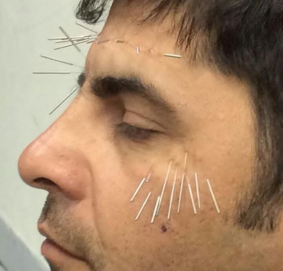 حجامت.زالودرمانی.فصدخون|خدمات آرایشگری و زیبایی|اسلامشهر, شهرک مهدیه|دیوار