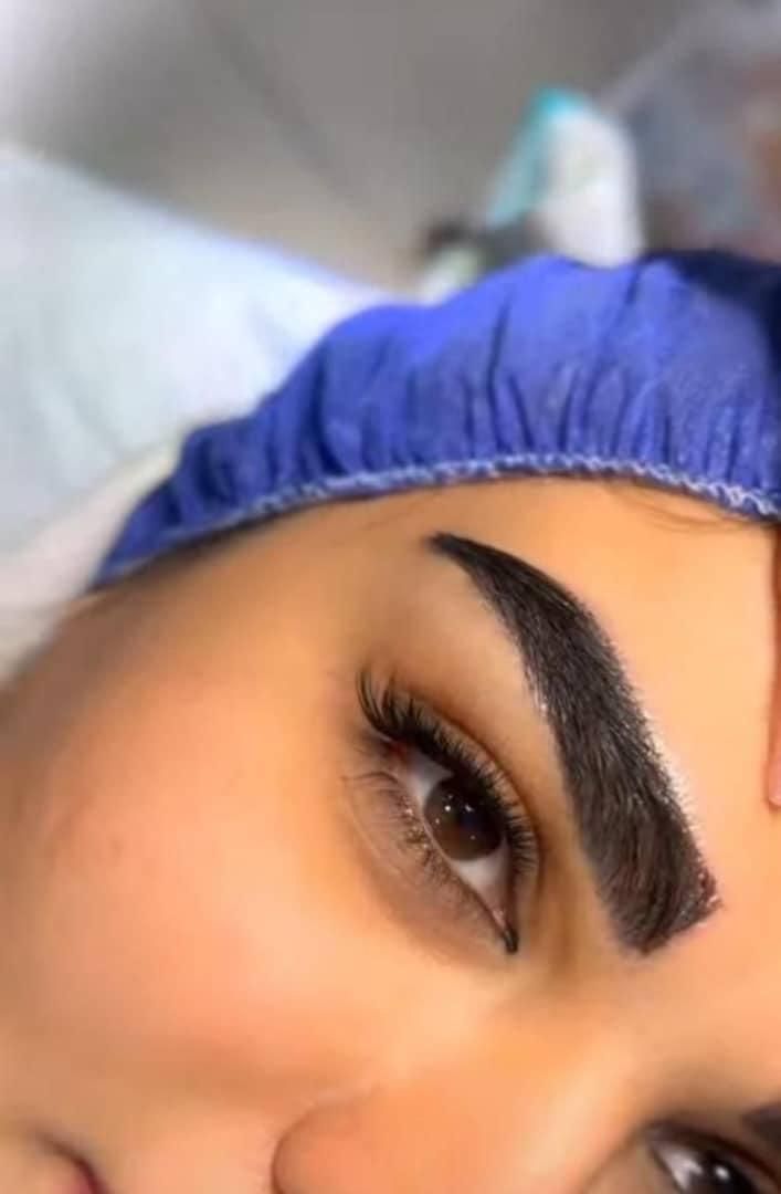 مزو،بوتاکس،چربی،فیلر،جراحی زیبایی صورت وبدن|خدمات آرایشگری و زیبایی|تهران, نارمک|دیوار