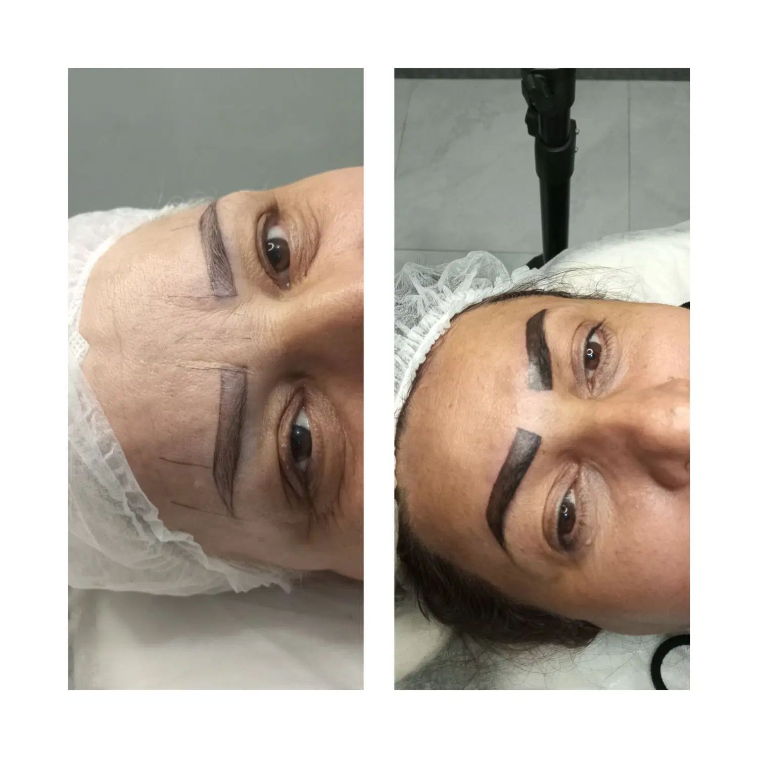 میکروبلیدینگ تغییررنگ تیره به روشن  وبوتاکس۴۵۰|خدمات آرایشگری و زیبایی|رشت, باهنر|دیوار