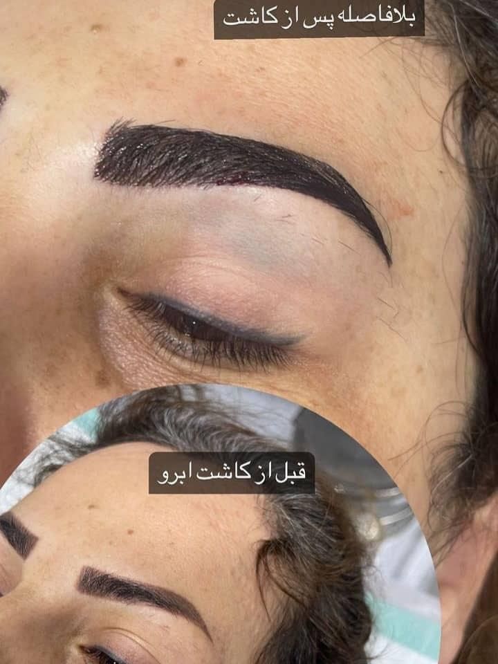 کاشت ابرو طبیعی و حرفه ای در کلینیک معتبر|خدمات آرایشگری و زیبایی|تهران, سهروردی|دیوار