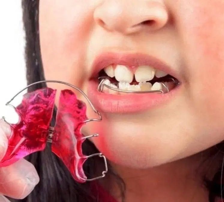 ارتودنسی مطب ماه|خدمات آرایشگری و زیبایی|تهران, عباس‌آباد|دیوار
