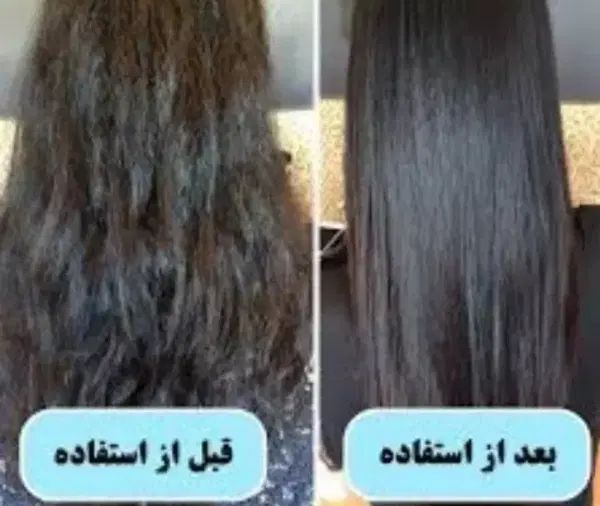با این سرم مو وزی و ریزش موهاتو از بین ببر|آرایشی، بهداشتی، درمانی|آبادان, |دیوار