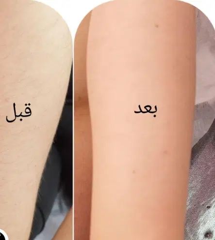تمام خدمات زیبایی اپیلاسیون اصلاح لیفت و لمینت|خدمات آرایشگری و زیبایی|مشهد, انقلاب|دیوار