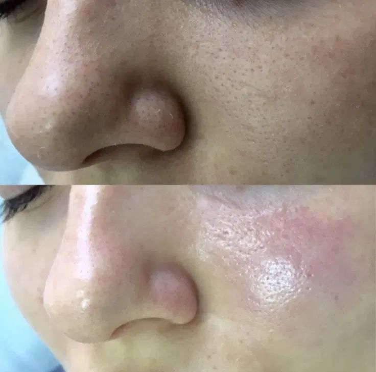 فشیال تخصصی و پاکسازی پوست در محیطی لوکس و آرام -|خدمات آرایشگری و زیبایی|قم, زنبیل آباد|دیوار