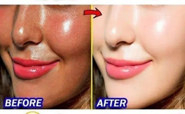کرم سفید کننده صورت وبدن 10درجه سفیدی|آرایشی، بهداشتی، درمانی|مشهد, کوه سنگی|دیوار