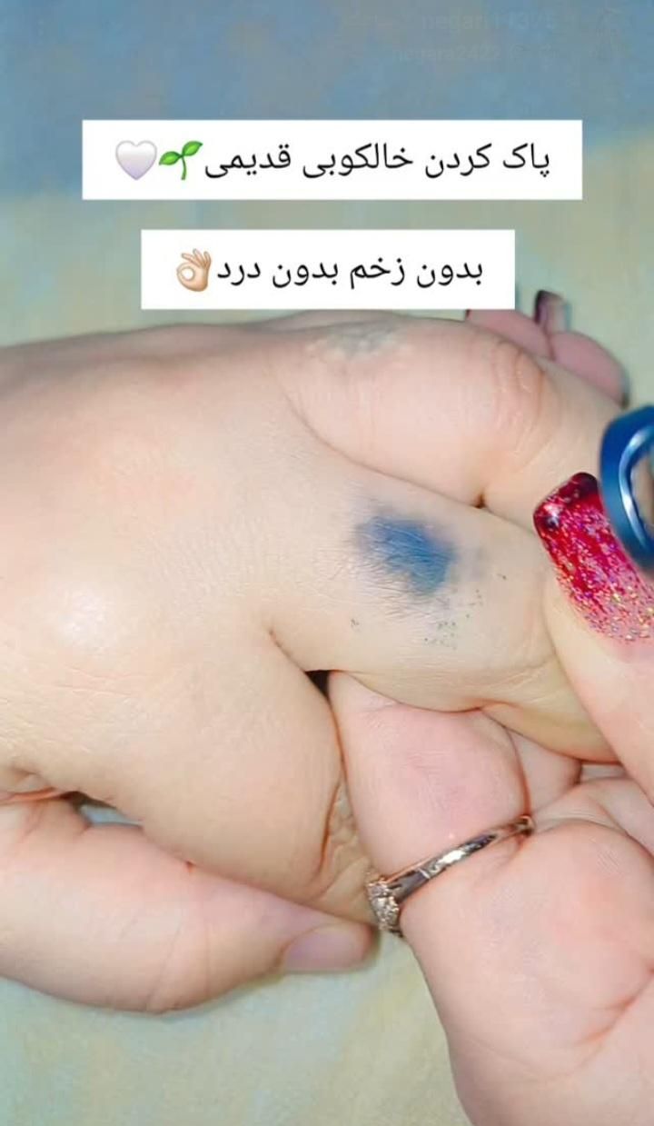 کربن تراپی(پلینگ هالیوودی)|خدمات آرایشگری و زیبایی|یزد, |دیوار