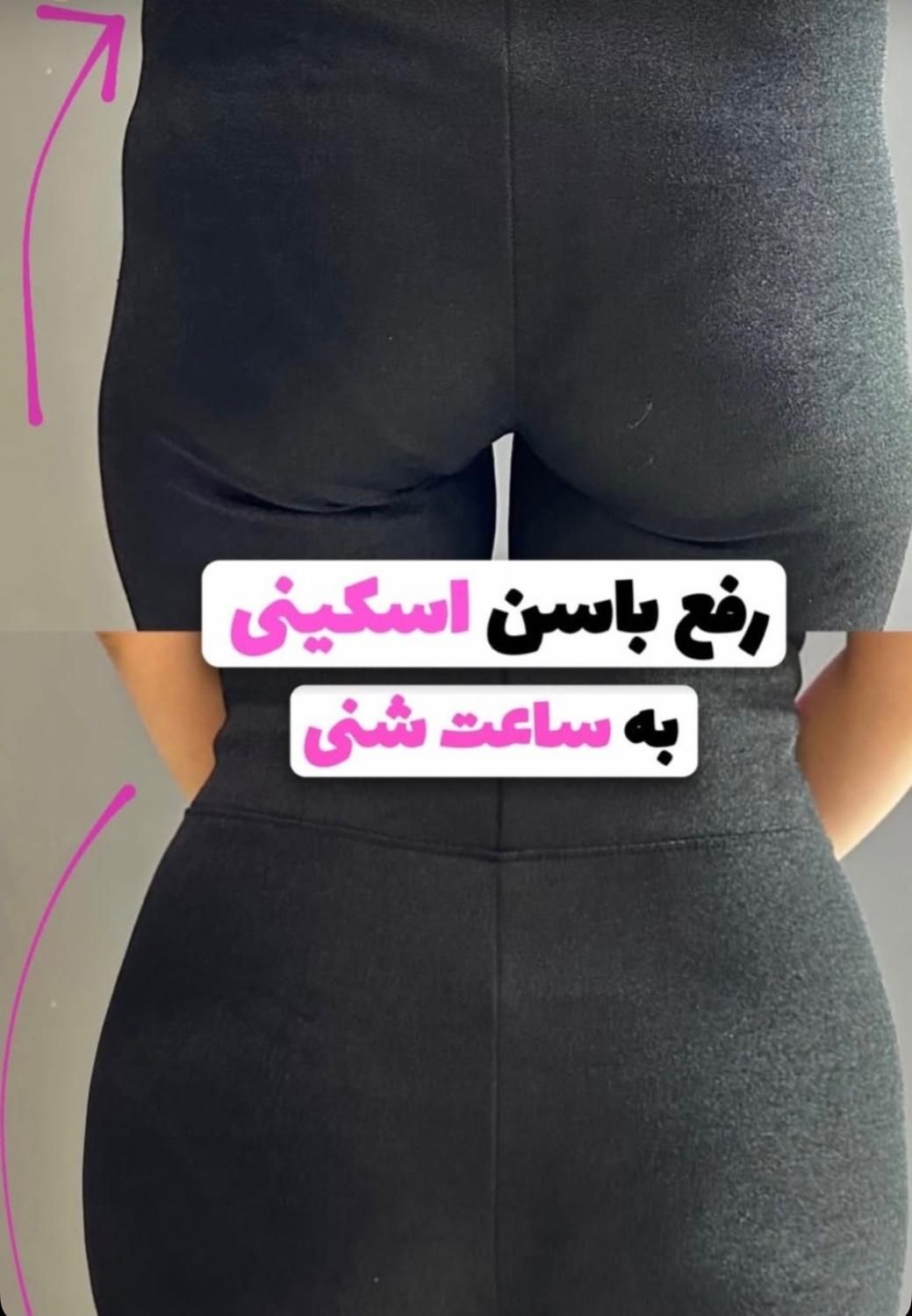 آموزش فیلربادی بامدرک دانشگاه همراه با مدل زدن|خدمات آموزشی|تهران, جردن|دیوار