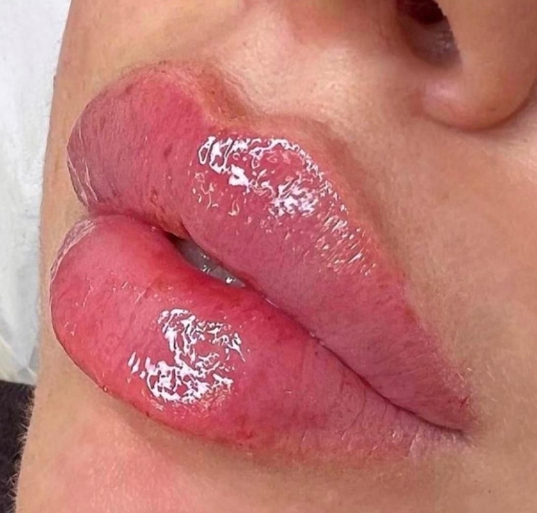 خدمات ژل و بوتاکس ، مزوتراپی سر و صورت|خدمات آرایشگری و زیبایی|شاهینشهر, فردوسی|دیوار