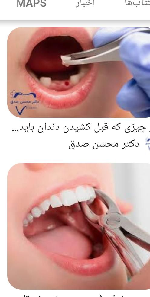 راهنمای برای کشیدن دندان|فعالیت داوطلبانه|پردیس, |دیوار