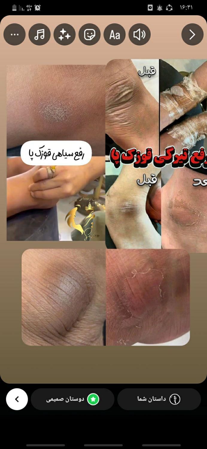 آموزش پیشرفته پدیکوروکفسابی|خدمات آموزشی|قم, آزادگان|دیوار