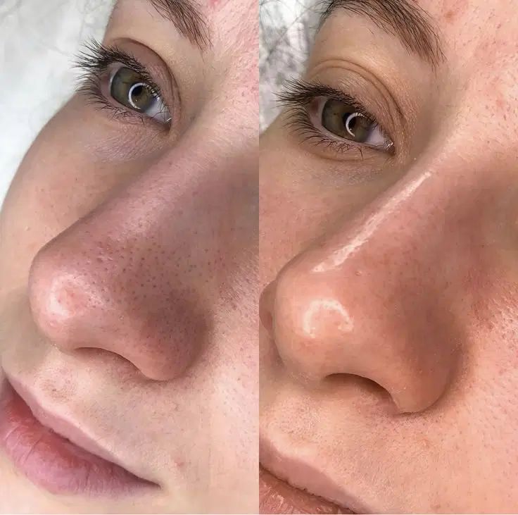 تخفیف تکرار نشدنی پکیج پاکسازی پوست صورت|خدمات آرایشگری و زیبایی|شوشتر, |دیوار
