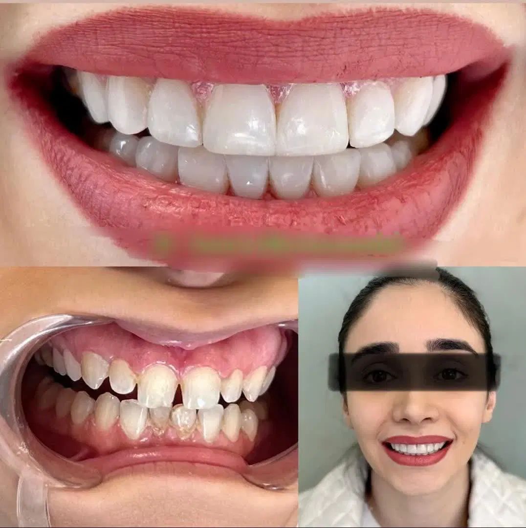 دندانپزشکی اقساط لمینت ایمپلنت و کلیه خدمات دندان|خدمات آرایشگری و زیبایی|مشهد, سجاد شهر|دیوار