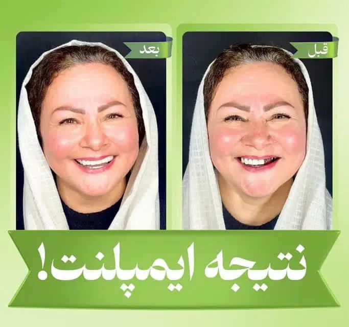 دندانپزشکی اقساط لمینت ایمپلنت و کلیه خدمات دندان|خدمات آرایشگری و زیبایی|مشهد, سجاد شهر|دیوار