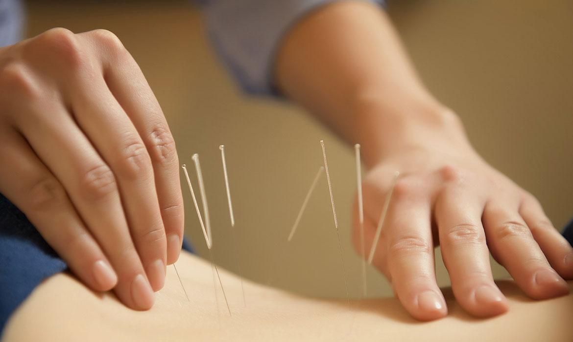 دوره تخصصی طب سوزنی با ارائه مدرک بین‌المللی|خدمات آموزشی|تهران, پیروزی|دیوار