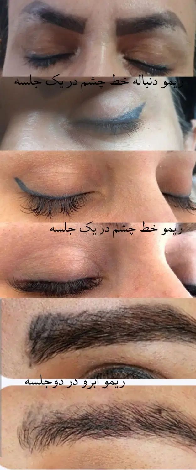 ریمو ابرو،چشم ولب|خدمات آرایشگری و زیبایی|تهران, افسریه شمالی|دیوار
