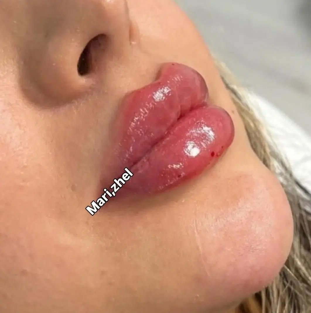 خدمات واموزش تخصصی ژل بوتاکس تتو چالگونه پرسینگ|خدمات آرایشگری و زیبایی|اهواز, کوی باهنر|دیوار