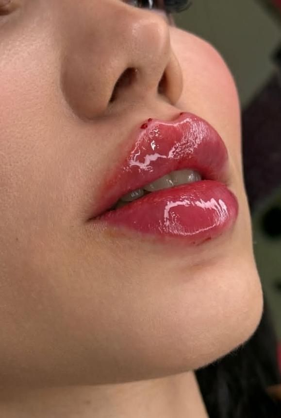 مرکز تخصصی افرینش لب روسی مادلینگ صورت بوتاکس و..|خدمات آرایشگری و زیبایی|اندیشه, |دیوار