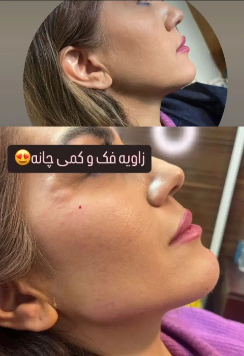 تخفیف 10 تا 20 درصدکلیه خدمات زیبایی در شمس ابادی|خدمات آرایشگری و زیبایی|اصفهان, خلجا|دیوار