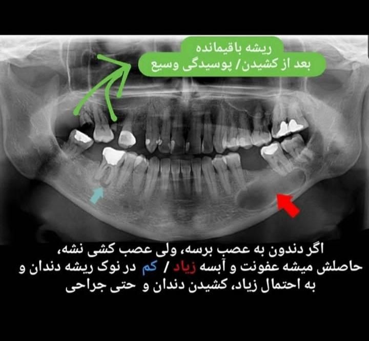 میخای تو 30 جلسه دندانسازی رو آموزش ببینی|خدمات آموزشی|ارومیه, |دیوار