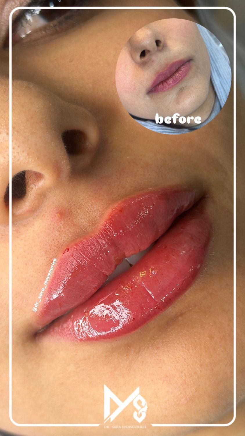 خدمات تخصصی ژل بوتاکس لیزر در کلینیک پزشکی|خدمات آرایشگری و زیبایی|شیراز, ارم|دیوار