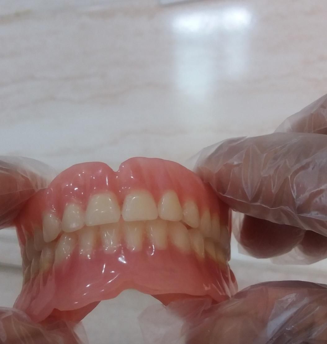 ساخت دندان مصنوعی متحرک|خدمات آرایشگری و زیبایی|صدرا-فارس, |دیوار